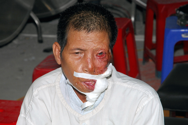 Quỹ Đạo Phật Ngày Nay: Tặng quà cho người khiếm thị, bệnh nhân ung bướu và trẻ em cơ nhỡ nhân Phật đản PL 2559
