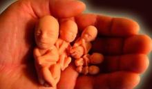 Bác sĩ phá thai tạo ác nghiệp, hình thù kỳ dị xuất hiện trên thân
